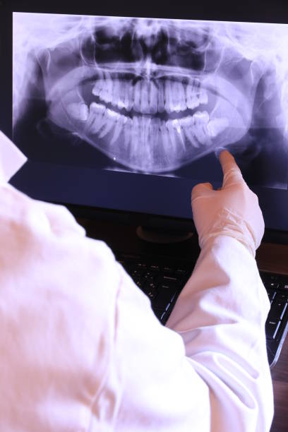 Best Emergency Root Canal Treatment in Fair Haven, NJ